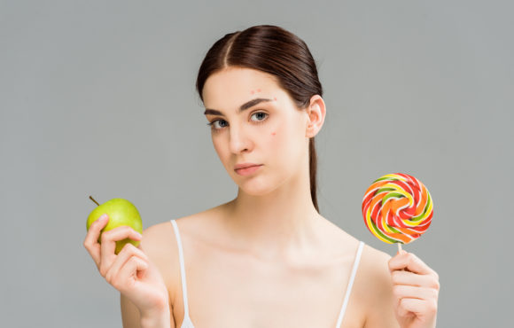 Dieta sana e acne