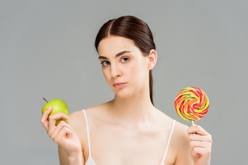 Dieta sana e acne